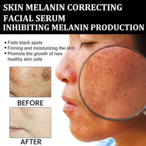 Eelhoe - Melanin Correcting Serum  30 Days Replacement Warranty